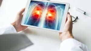 Career Opportunities With Radiologic Training