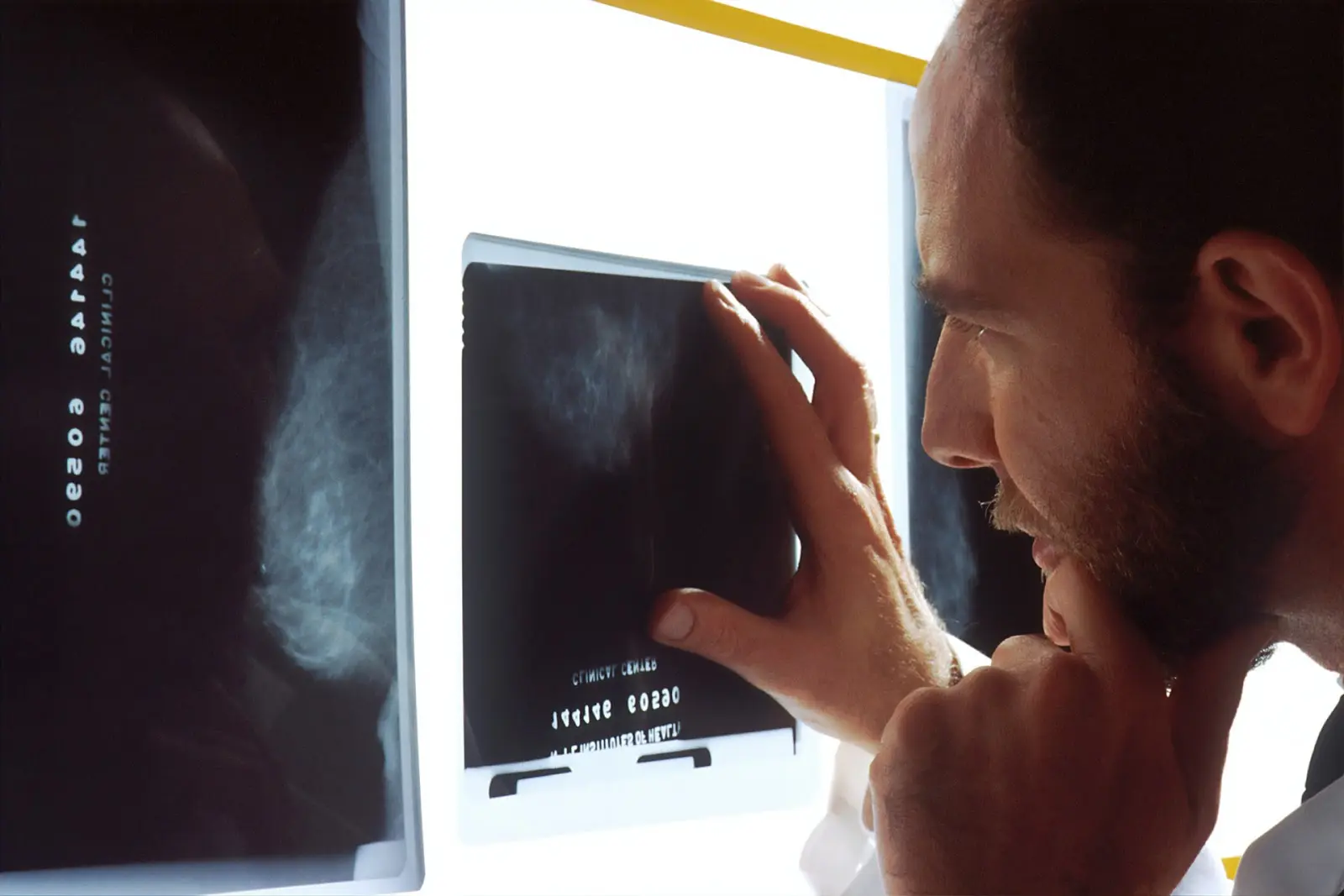 Male technologist reviews patient's medical image