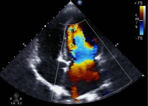 What Does a Cardiovascular Sonographer Do? | Gurnick Academy of Medical Arts